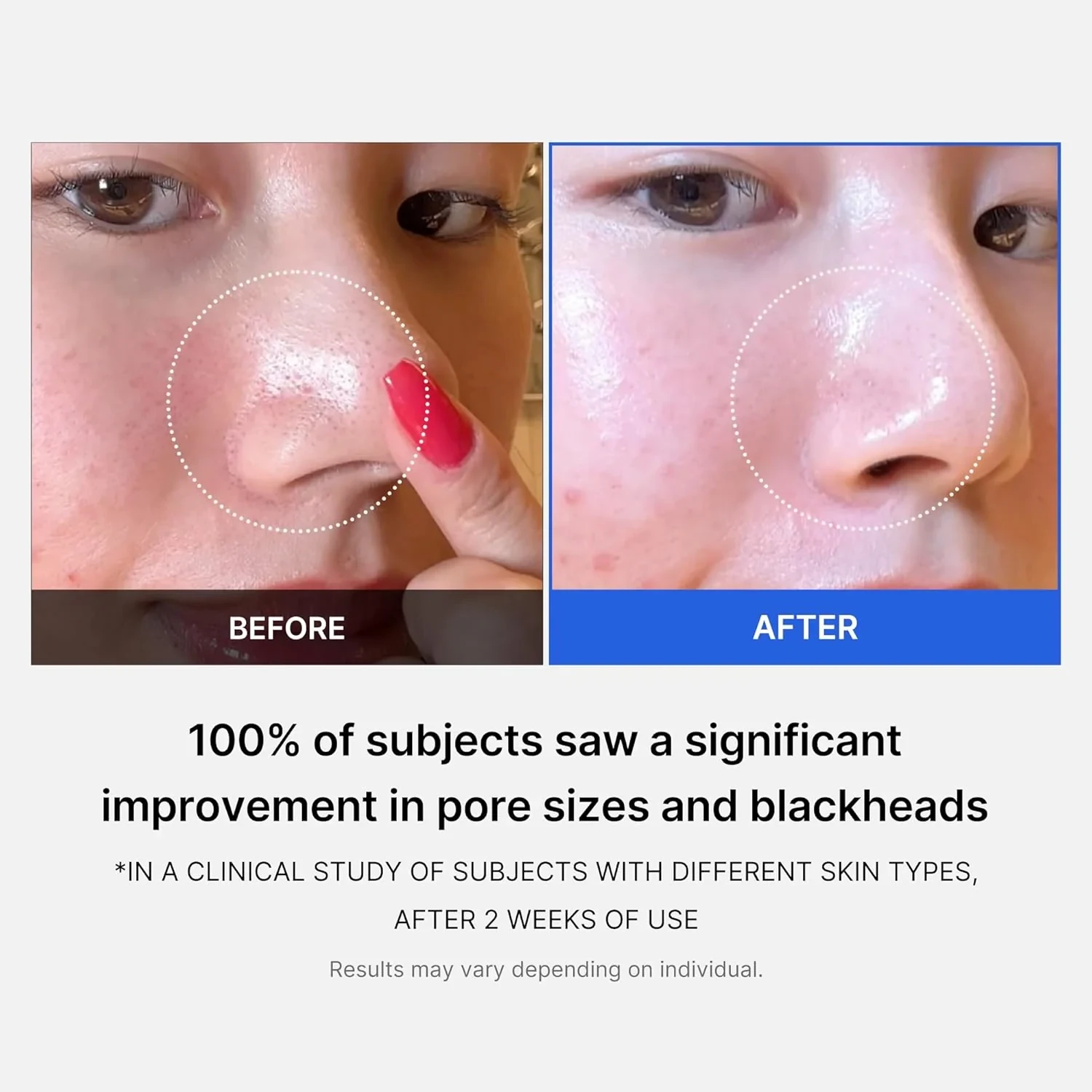 MEDICUBE Zero Pore Pad 2.0 (70pcs)