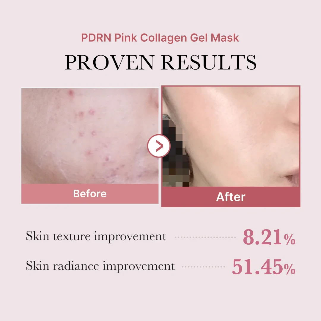MEDICUBE PDRN Pink Collagen Gel Mask (1ea)